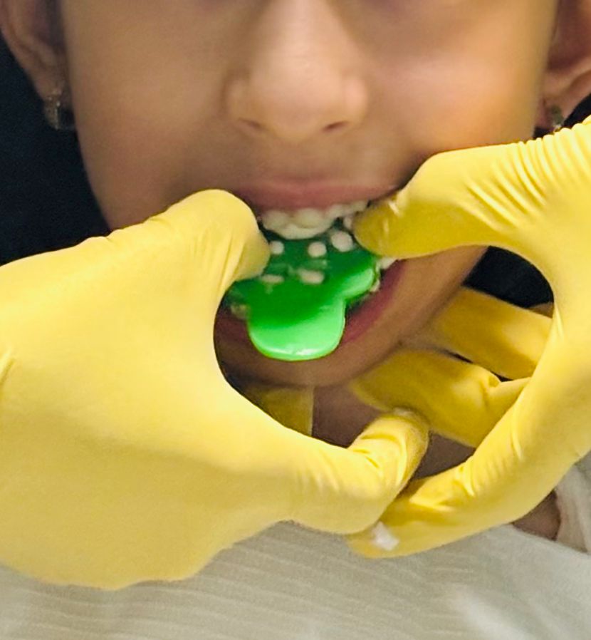 Ortodoncia infantil en Monterrey: ortopedia maxilar guiando el crecimiento de los huesos del niño