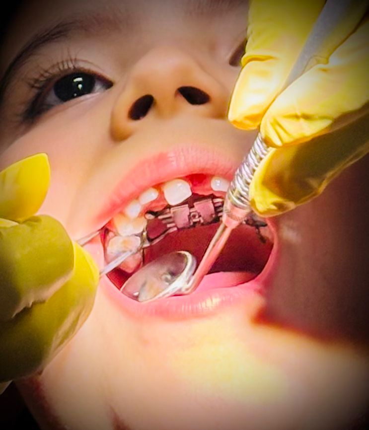 Ortodoncia con brackets en Monterrey: dentista atendiendo paciente con brackets en Especialidades Dentales