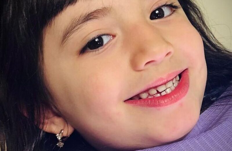 Sonrisa natural — carillas y blanqueamiento dental